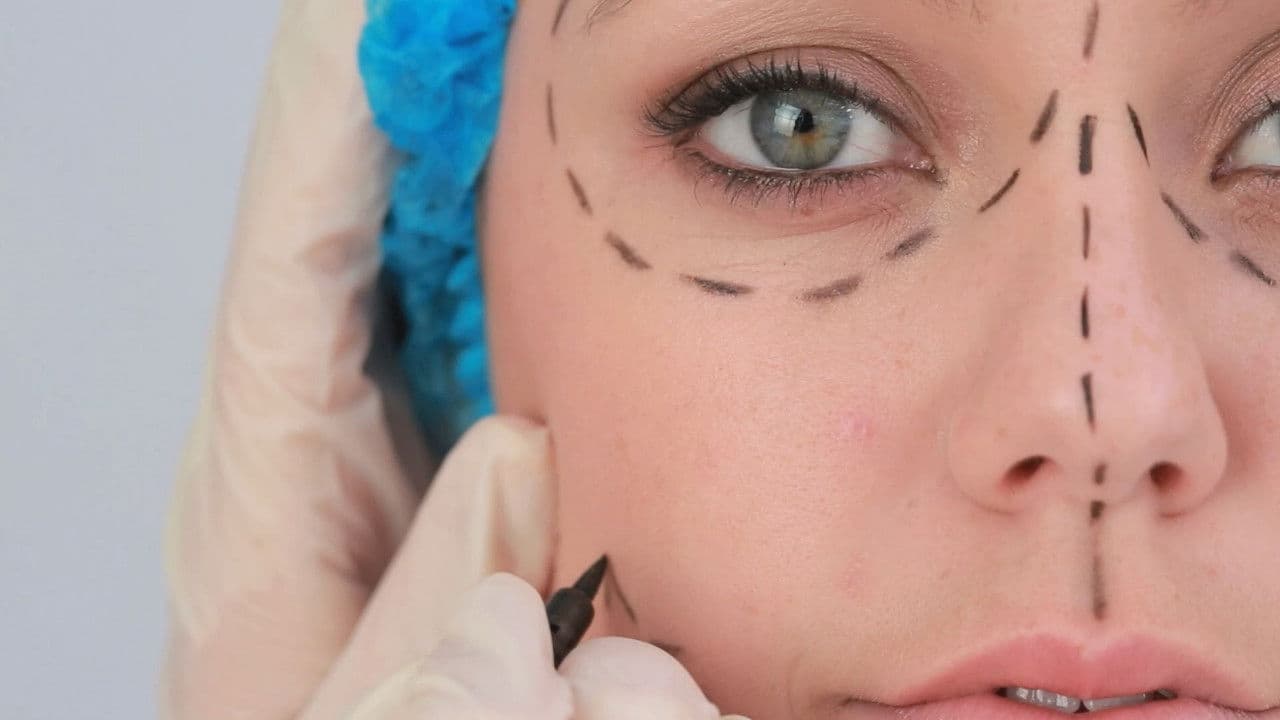 Plastic Surgery Knifemares